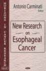 Image for New Research on Esophageal Cancer