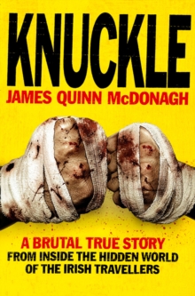 Knuckle