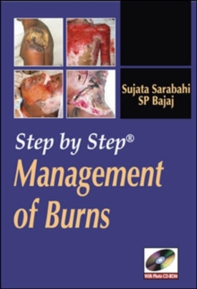Image for Step by Step Management of Burns