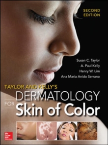 Image for Taylor and Kelly's Dermatology for Skin of Color 2/E