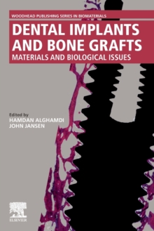 Dental Implants and Bone Grafts