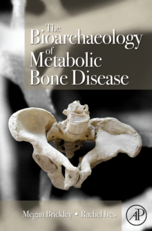 Bioarchaeology of Metabolic Bone Disease