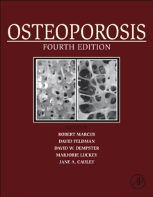 Image for Osteoporosis.