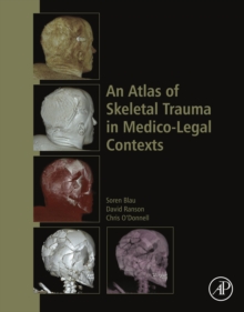 Image for An Atlas of Skeletal Trauma in Medico-Legal Contexts