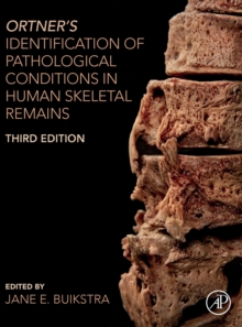 Image for Ortner's identification of pathological conditions in human skeletal remains