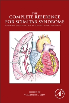 Image for The complete reference for scimitar syndrome: anatomy, epidemiology, diagnosis and treatment