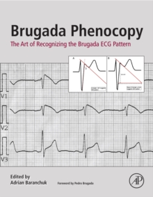 Image for Brugada phenocopy: the art of recognizing the Brugada ECG pattern