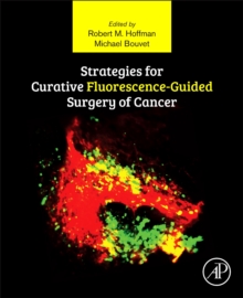 Image for Strategies for Curative Fluorescence-Guided Surgery of Cancer