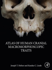 Image for Atlas of human cranial macromorphoscopic traits