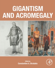 Image for Gigantism and Acromegaly