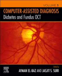 Image for Diabetes and Fundus OCT
