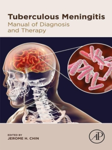 Image for Tuberculous Meningitis: Manual of Diagnosis and Therapy