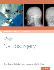 Image for Pain Neurosurgery