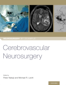 Image for Cerebrovascular Neurosurgery
