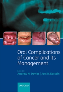 Image for Oral complications of cancer and its management