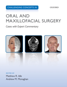 Image for Challenging concepts in oral and maxillofacial surgery: cases with expert commentary