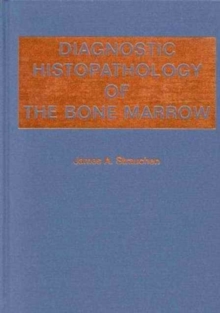 Diagnostic Histopathology of the Bone Marrow