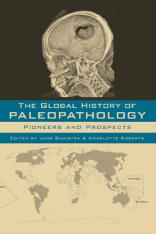 Global History of Paleopathology