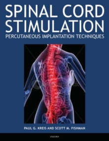 Image for Spinal Cord Stimulation