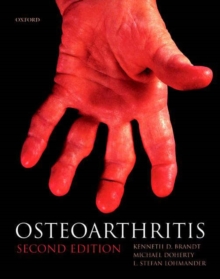 Image for Osteoarthritis