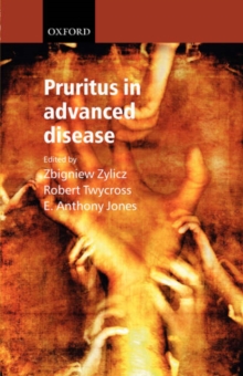 Image for Pruritus in advanced disease