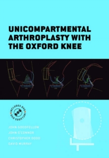 Image for The Oxford Knee