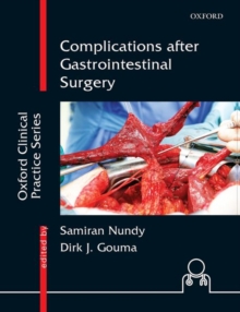 Image for Complications after gastrointestinal surgery