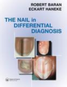 Image for Nail in differential diagnosis