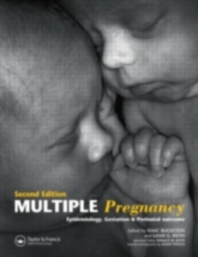 Image for Multiple pregnancy: epidemiology, gestation & perinatal outcome
