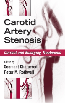 Image for Carotid artery stenosis: current and emerging treatments