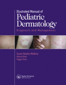 Image for Illustrated manual of pediatric dermatology: diagnosis and management