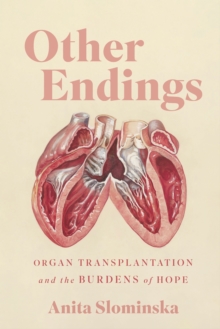 Other Endings