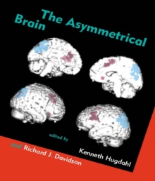Image for Asymmetrical Brain