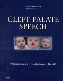 Image for Cleft palate speech