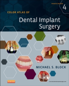Image for Color atlas of dental implant surgery