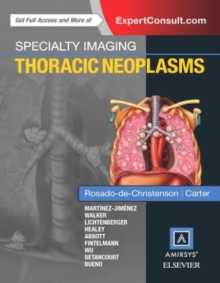 Image for Specialty Imaging: Thoracic Neoplasms