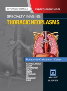 Image for Thoracic neoplasms