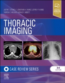 Image for Thoracic Imaging: Case Review