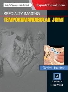Image for Specialty Imaging: Temporomandibular Joint