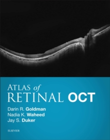 Image for Atlas of retinal OCT: optical coherence tomography
