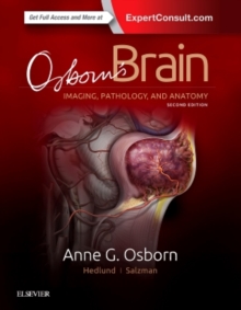 Image for Osborn's Brain