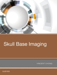 Image for Skull Base Imaging