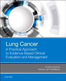 Image for Lung Cancer: A Practical Approach to Evidence-Based Clinical Evaluation and Management