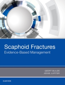 Image for Scaphoid fractures: evidence-based management