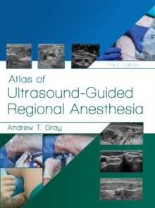 Image for Atlas of ultrasound-guided regional anesthesia
