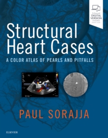 Image for Structural heart cases: a color atlas of pearls and pitfalls