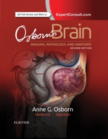 Image for Osborn's brain.