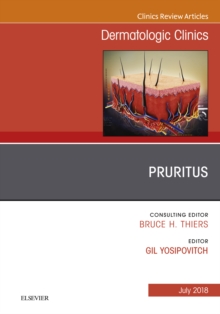 Image for Pruritus