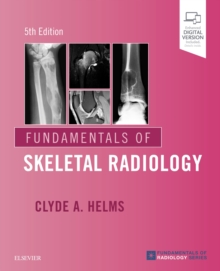 Fundamentals of Skeletal Radiology