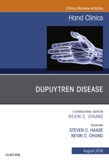 Image for Dupuytren disease